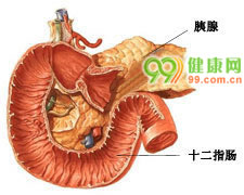 胰腺假性囊肿