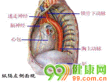 纵隔脓肿