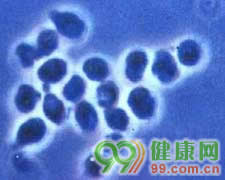 球孢子菌病