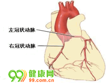 胸降主动脉动脉瘤