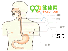 食管贲门粘膜撕裂综合征