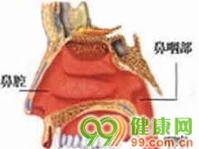 鼻咽肉瘤