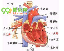 先天性主动脉瓣上狭窄